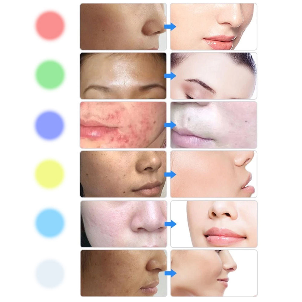 Aparat facial cu LED inSPORTline Coladome 600 24986 (7957)