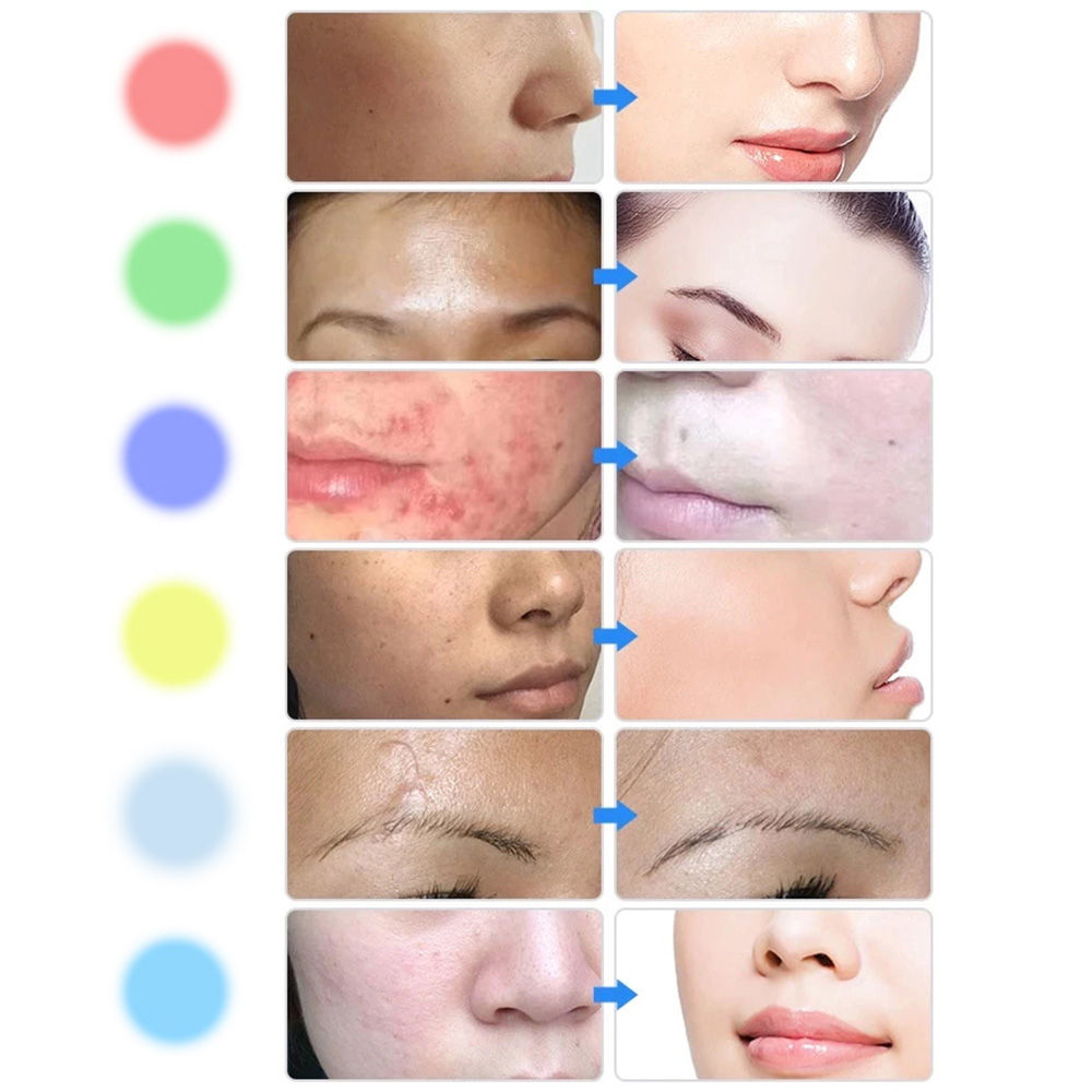 Aparat facial cu LED inSPORTline Coladome 900 24987 (7958)